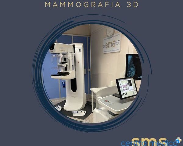 Mammografia 3d in Tomosintesi